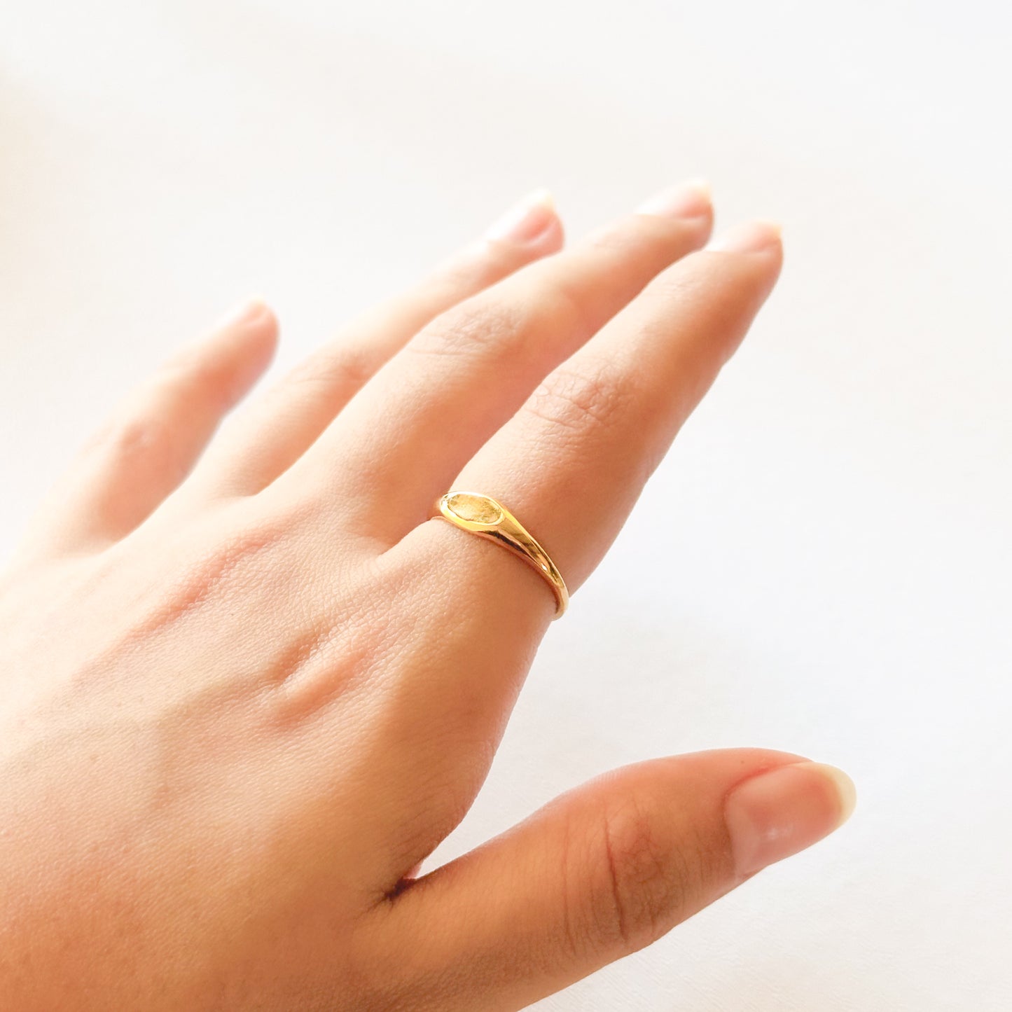 Anillo Lera